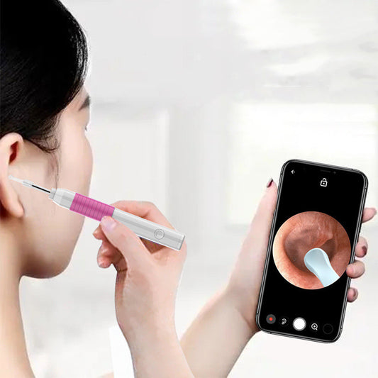 New HD Intelligent Endoscope Tool